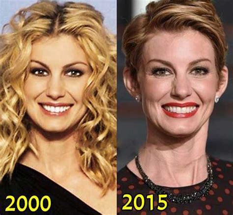 has faith hill had plastic surgery|Faith Hill’s Plastic Surgery in 2021: Does the People Magazine。